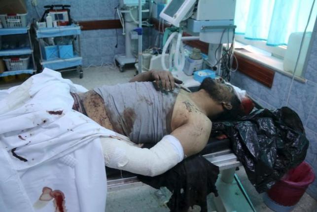 A man who was injured after a U.S. airstrike against Islamic State is pictured, in Sabratha