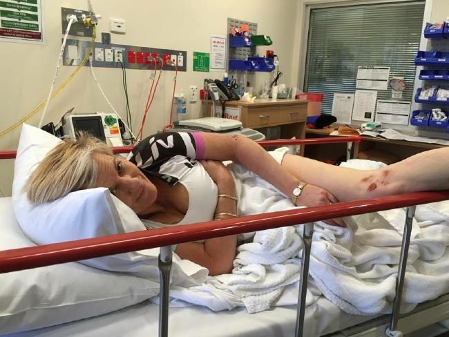 После нападения кенгуру австралийке необходима замена грудных имплантов