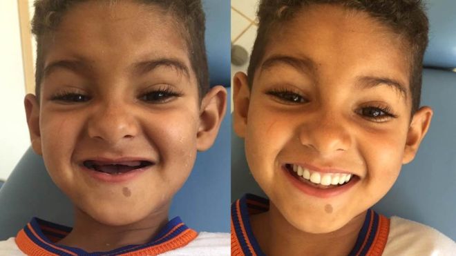 Маленькое чудо из Бразилии: как врач научила ребенка улыбаться